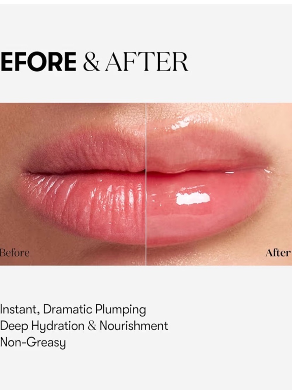 VT Cosmetics Reedle Shot Lip Plumper - Picture 4 of 6